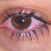 Aesthetic Eye