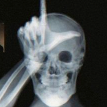 Xray L